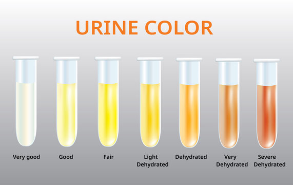 urine color